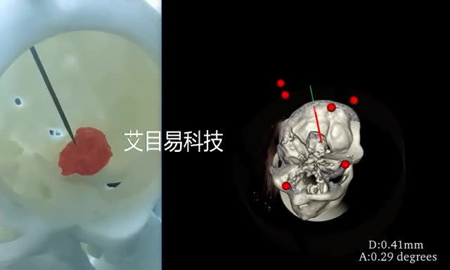 科学研究与rTMS神经调控：V***r2神经导航系统为精神疾病***带来突破